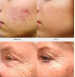 Retinol + Collagen, Hyaluronic Acid, Vitamin C AntiAging Wrinkle Serum Cream 4oz - Image 2